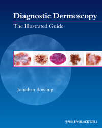ダーモスコピー画像診断ガイド<br>Diagnostic Dermoscopy : The Illustrated Guide