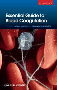 Essential Guide to Blood Coagulation（2）
