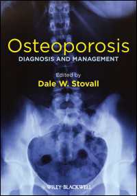 Osteoporosis : Diagnosis and Management