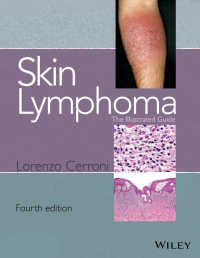 皮膚リンパ腫：図解ガイド（第４版）<br>Skin Lymphoma : The Illustrated Guide（4）