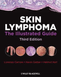 皮膚リンパ腫：図解ガイド（第３版）<br>Skin Lymphoma : The Illustrated Guide（3）