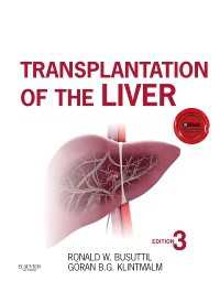 肝臓移植（第３版）<br>Transplantation of the Liver（3）