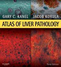 肝臓病理学アトラス（第３版）<br>Atlas of Liver Pathology E-Book : Expert Consult - Online and Print（3）