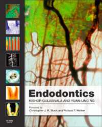 歯内治療学（第４版）<br>Endodontics E-Book : Endodontics E-Book（4）