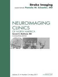 Imaging of Ischemic Stroke, An Issue of Neuroimaging Clinics : Imaging of Ischemic Stroke, An Issue of Neuroimaging Clinics