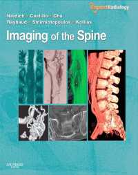 脊椎：エキスパート画像診断シリーズ<br>Imaging of the Spine E-Book : Expert Radiology Series