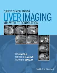 Liver Imaging : MRI with CT Correlation