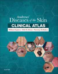 アンドリュース臨床皮膚病学アトラス<br>Andrews' Diseases of the Skin Clinical Atlas E-Book : Expert Consult