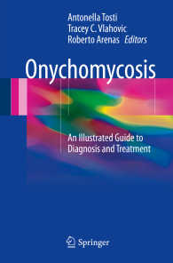 Onychomycosis : An Illustrated Guide to Diagnosis and Treatment