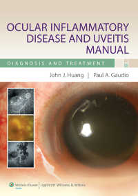 Ocular Inflammatory Disease and Uveitis Manual : Diagnosis and Treatment