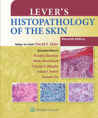 レーバー皮膚組織病理学（第１１版）<br>Lever's Histopathology of the Skin（11）