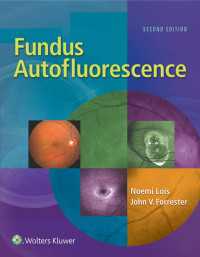Fundus Autofluorescence（2）