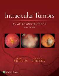 Intraocular Tumors: An Atlas and Textbook（3）
