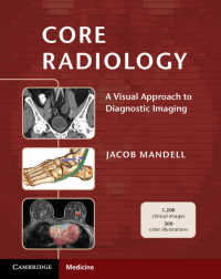 コア放射線医学<br>Core Radiology : A Visual Approach to Diagnostic Imaging