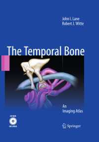 Temporal Bone : An Imaging Atlas