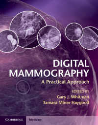 デジタル・マンモグラフィ：実践アプローチ<br>Digital Mammography : A Practical Approach