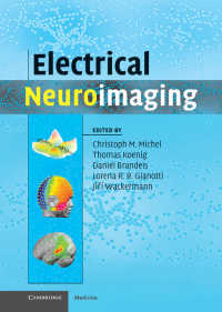 最新神経画像処理<br>Electrical Neuroimaging