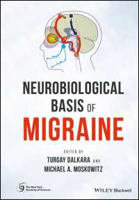片頭痛の神経生物学的基礎<br>Neurobiological Basis of Migraine