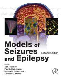 痙攣とてんかんのモデル（第２版）<br>Models of Seizures and Epilepsy（2）