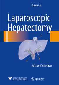 Laparoscopic Hepatectomy : Atlas and Techniques