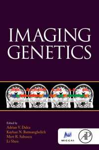 脳画像－遺伝子関連研究<br>Imaging Genetics