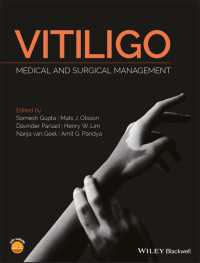 Vitiligo : Medical and Surgical Management