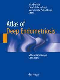 深部子宮内膜症アトラス：MRI・腹腔鏡<br>Atlas of Deep Endometriosis : MRI and Laparoscopic Correlations