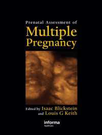 多胎妊娠の出産前の評価<br>Prenatal Assessment of Multiple Pregnancy