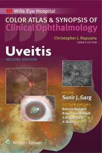 ブドウ膜炎：臨床眼科学カラーアトラス・要説（第２版）<br>Uveitis（2）