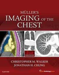 胸部：エキスパート画像診断シリーズ（第２版）<br>Muller's Imaging of the Chest E-Book : Expert Radiology Series（2）