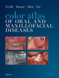 口腔・顎顔面疾病カラーアトラス<br>Color Atlas of Oral and Maxillofacial Diseases - E-Book : Color Atlas of Oral and Maxillofacial Diseases - E-Book