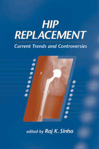 人工股関節置換<br>Hip Replacement : Current Trends and Controversies