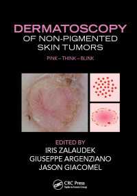 Dermatoscopy of Non-Pigmented Skin Tumors : Pink - Think - Blink