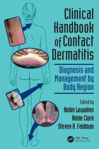 接触皮膚炎：臨床ハンドブック<br>Clinical Handbook of Contact Dermatitis : Diagnosis and Management by Body Region