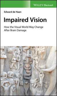 脳の損傷と視覚障害<br>Impaired Vision : How the Visual World May Change after Brain Damage