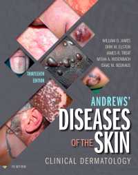 アンドリュース臨床皮膚病学（第１３版）<br>Andrews' Diseases of the Skin : Clinical Dermatology（13）