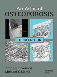 骨粗鬆症アトラス（第３版）<br>An Atlas of Osteoporosis（3 NED）