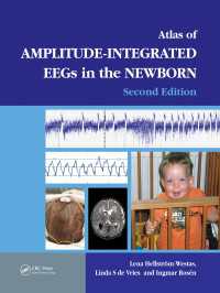 An Atlas of Amplitude-Integrated EEGs in the Newborn（2 NED）