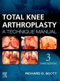 Total Knee Arthroplasty E-Book : A Technique Manual（3）