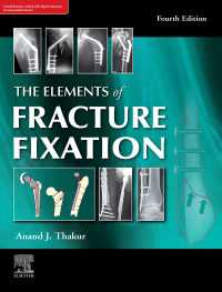 The elements of fracture fixation, 4e（4）