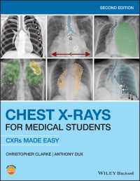 医学生のための胸部Ｘ線（第２版）<br>Chest X-Rays for Medical Students : CXRs Made Easy（2）
