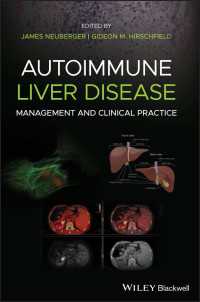 Autoimmune Liver Disease : Management and Clinical Practice