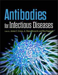 感染症の抗体<br>Antibodies for Infectious Diseases