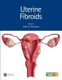 Uterine Fibroids