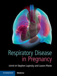 妊娠時の呼吸器疾患<br>Respiratory Disease in Pregnancy