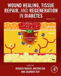 Wound Healing, Tissue Repair, and Regeneration in Diabetes