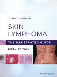 皮膚リンパ腫：図解ガイド（第５版）<br>Skin Lymphoma : The Illustrated Guide（5）