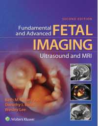 胎児画像診断：超音波とMRI（第２版）<br>Fundamental and Advanced Fetal Imaging Ultrasound and MRI（2）