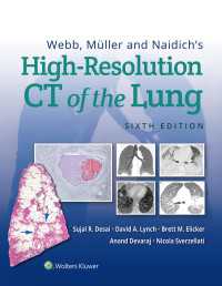 肺の高解像度ＣＴ（第６版）<br>Webb, Müller and Naidich's High-Resolution CT of the Lung（6）
