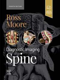 脊椎：画像診断（第４版）<br>Diagnostic Imaging: Spine - E-Book : Diagnostic Imaging: Spine - E-Book（4）
